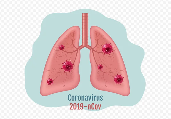 Longen Human Internal Organ met Coronavirus geïsoleerde transparante achtergrond — Stockvector