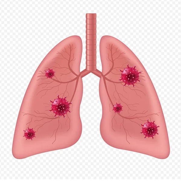 Lungs Órgano Interno Humano Con Coronavirus Aislado Fondo Blanco — Archivo Imágenes Vectoriales