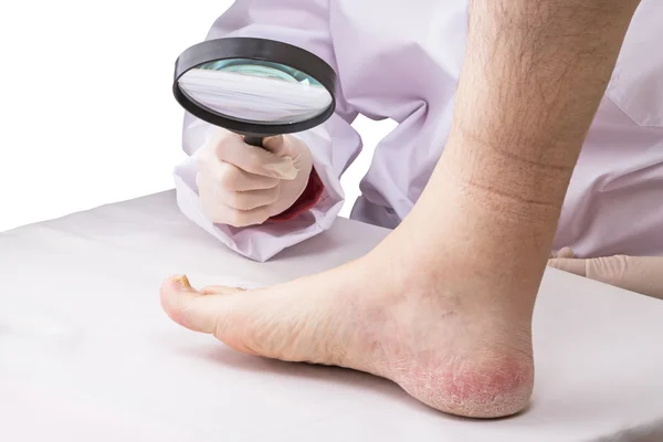 Doctor with magnifying glass and affected leg — Stock Photo, Image