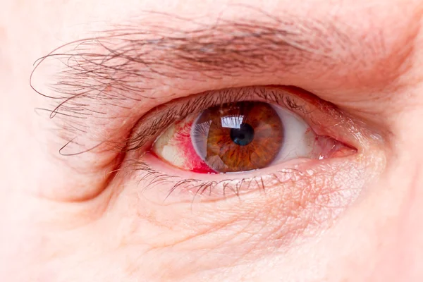 Röd mänskliga ögat — Stockfoto