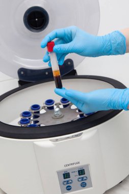 Mavi eldivenli eller, santrifüjün önünde bir numune bulunan bir test tüpü tutuyor..