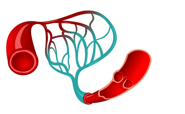 Ilustración médica capilar — Vector de stock