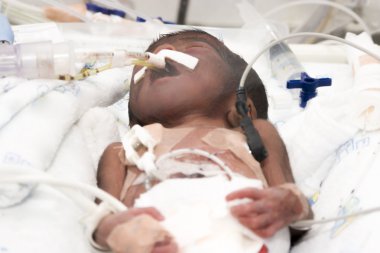 Yeni doğmuş bebek küvezde.