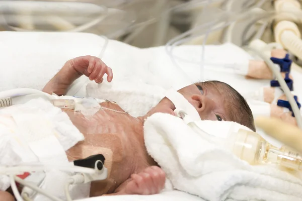 Newborn baby inside incubator — Stock Photo, Image