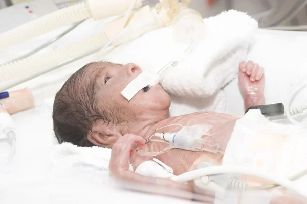 Nyfött barn i inkubatorn — Stockfoto