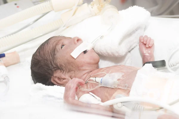 Newborn baby inside incubator — Stock Photo, Image