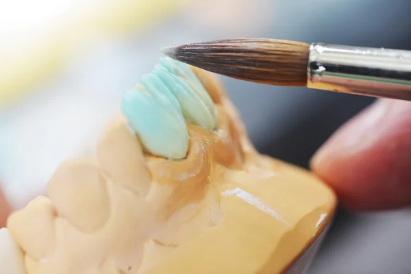 Dental technician working on false teeth — Stock Photo, Image