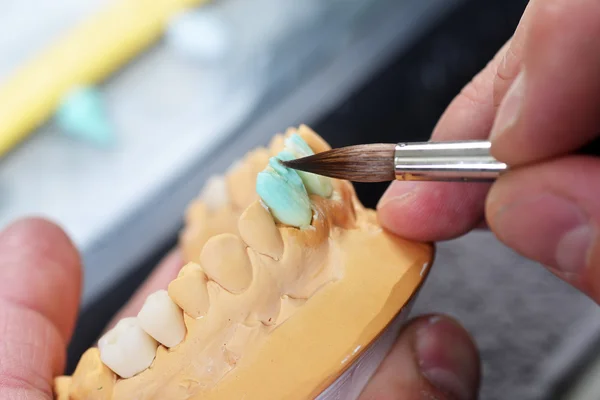 Зубной техник, работающий над ложными зубами Стоковое Изображение