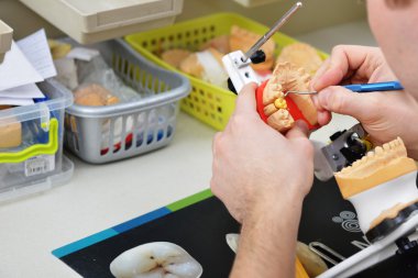 Diş teknisyeni takma diş üzerinde çalışma