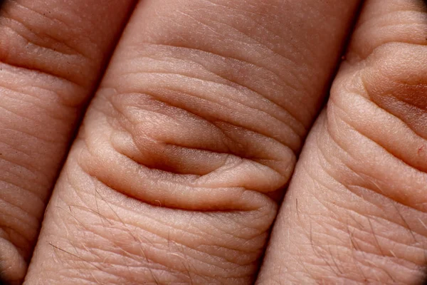 Folds Skin Fingers Close — Stock Photo, Image