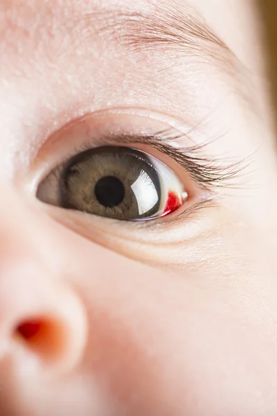 Červená bloddshot oči — Stock fotografie