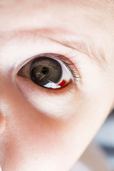 Red bloddshot eyes — Stock Photo, Image