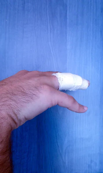Gewond pijnlijke mannenhand vinger — Stockfoto