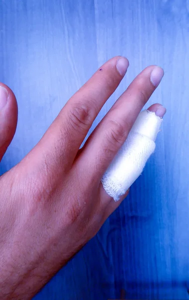 Zraněný prst bolestivé mužské ruky — Stock fotografie