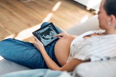 Hamile bir kadının bebek ultrasonuna bakıp evdeki kanepede oturması.