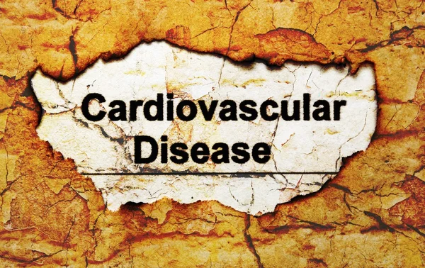 Doença cardiovascular — Fotografia de Stock