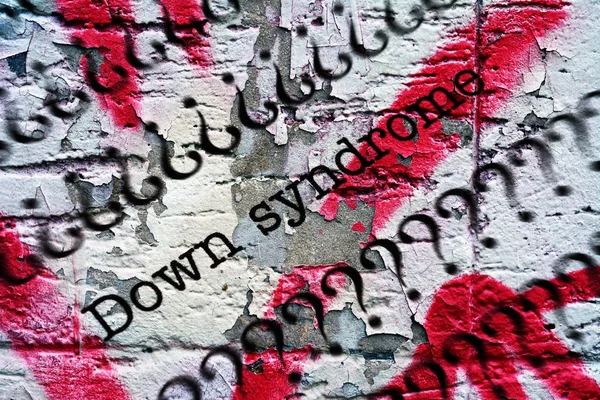 Syndrome de Down — Photo