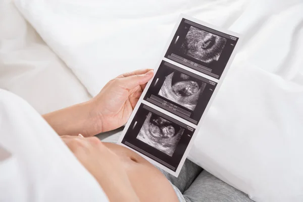 Mulher grávida com ultra-som do bebê — Fotografia de Stock