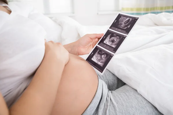 Mulher grávida com imagem ultra-sonográfica — Fotografia de Stock