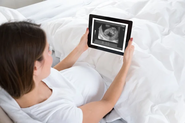 Pregnant Woman Looking At X-ray — Stock Photo, Image