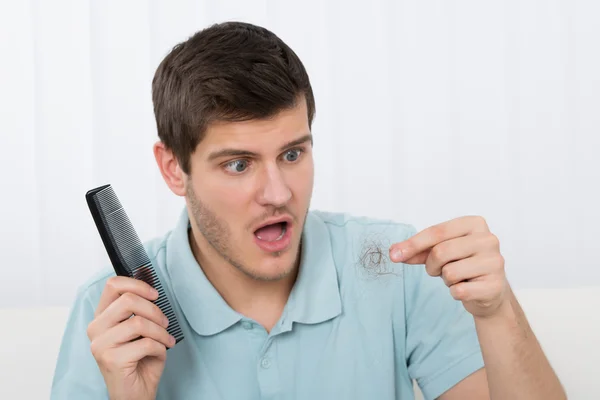 Hombre joven que sufre de pérdida de cabello —  Fotos de Stock