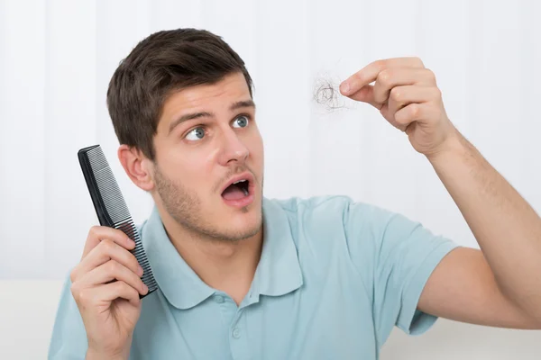 Homem com perda de cabelo — Fotografia de Stock