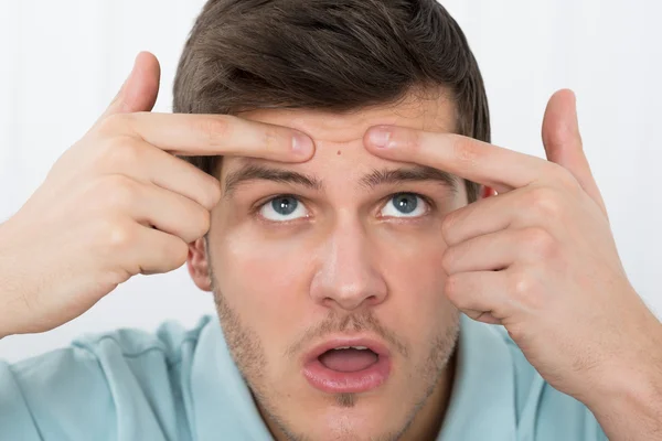 Man Looking At Pimple — Stock Photo, Image
