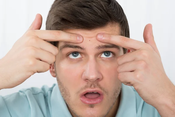 Homem olhando para Pimple — Fotografia de Stock