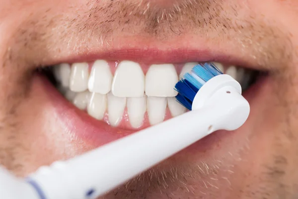 Dentes de homem com escova de dentes elétrica — Fotografia de Stock