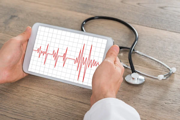 Mannelijke arts weergegeven: Heartbeat op digitale Tablet — Stockfoto