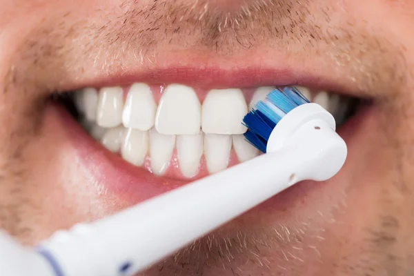 Dientes de hombre con cepillo de dientes eléctrico Fotos De Stock Sin Royalties Gratis