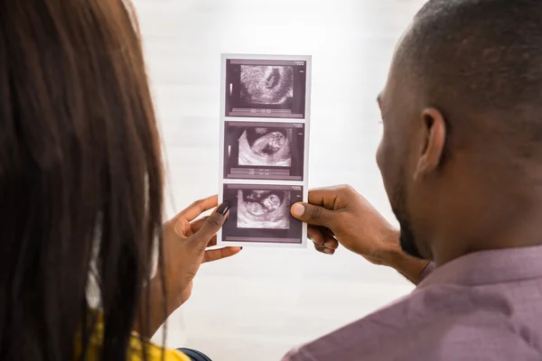 Casal com ultra-som relatório de digitalização — Fotografia de Stock