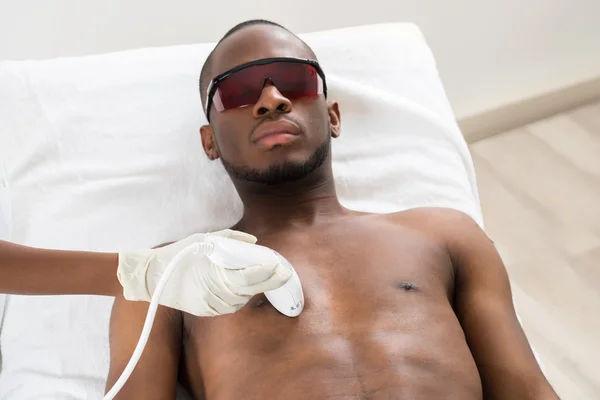 Laser-epilatie op mannelijke borst — Stockfoto