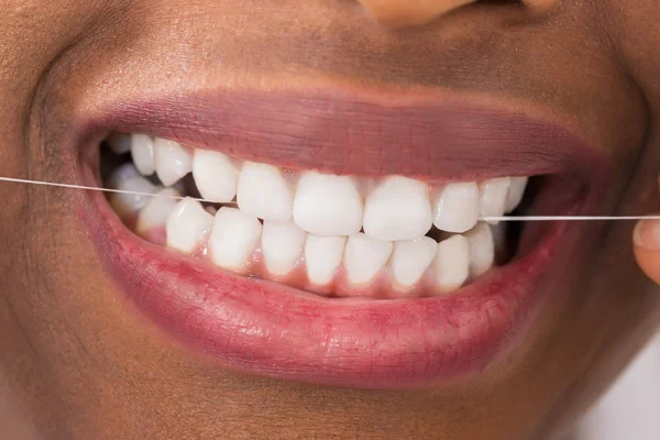 Dientes de hilo dental mujer — Foto de Stock
