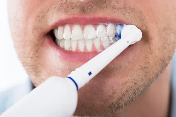 男性的牙齿，用电动牙刷 — 图库照片