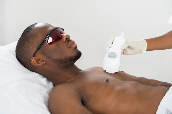 Laser Epilation on Male Chest — Stock Photo, Image