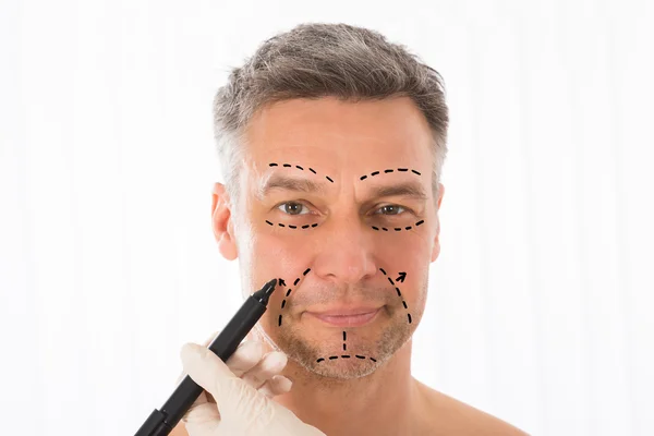 Lignes de correction sur le visage de l'homme — Photo