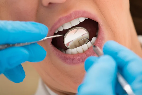 Paciente examinando seus dentes — Fotografia de Stock