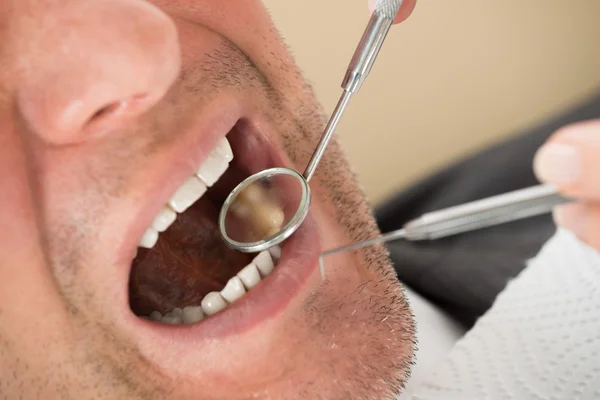 Man undersökas av tandläkare — Stockfoto