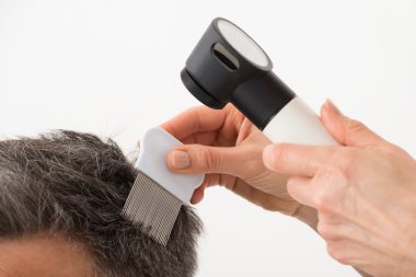 Hastanın saç inceleyerek Dermatoscope olan kişi