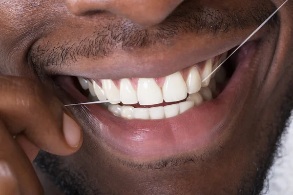 Adam dişlerini Temizleme — Stok fotoğraf