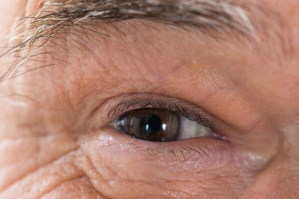 Senior Man's Eye