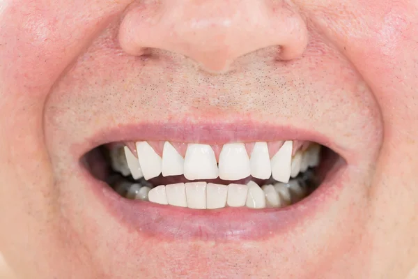 Homem sênior mostrando seus dentes — Fotografia de Stock