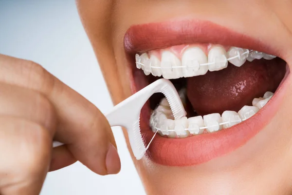 Θηλυκός Καθαρισμός Οδοντικών Βραχιόνων Στο Στόμα Χρησιμοποιώντας Ραβδί Floss — Φωτογραφία Αρχείου