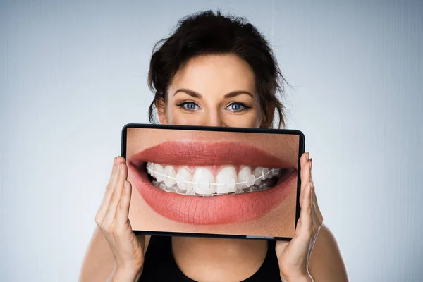 Fondo Donna Ritratto Con Bretelle Dentali Tablet — Foto Stock