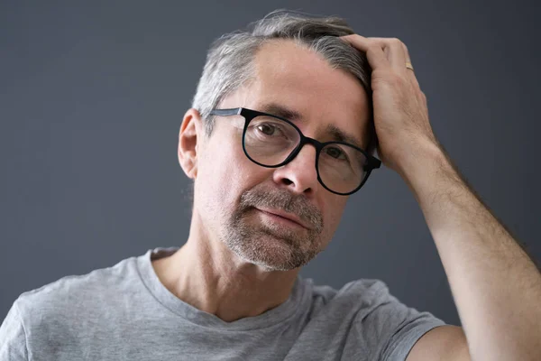 Balding Man Losing Hair Checking Scalp Hair Loss — Stock Photo, Image