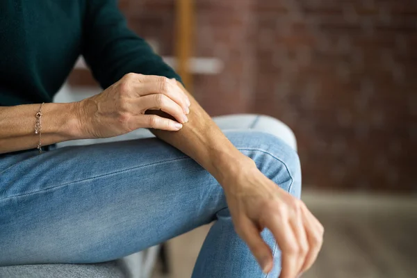 Frau Kratzt Juckende Körperhaut Mit Allergie — Stockfoto