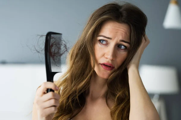 Mulher Sofrendo Perda Cabelo Problema Queda Cabelo — Fotografia de Stock