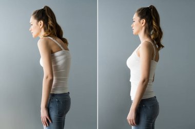 Back Pain Abdominal Posture Before And After clipart