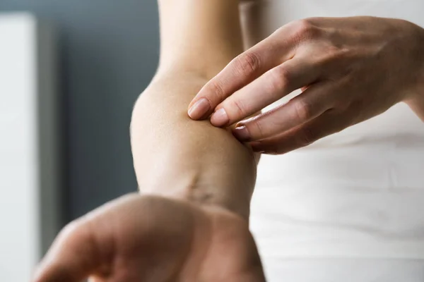 Vrouw Krabben Jeuk Lichaam Huid Met Allergie — Stockfoto